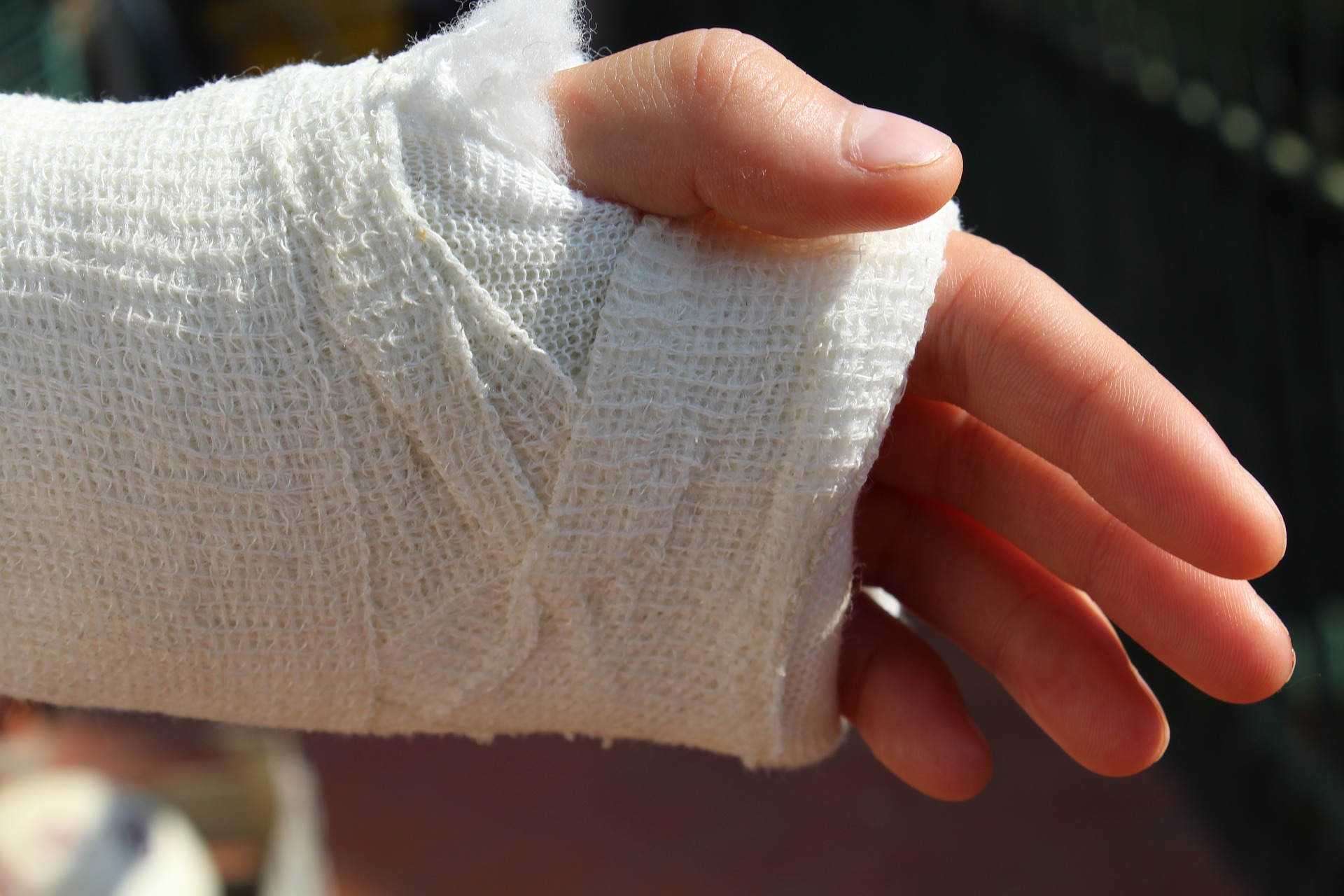 motorcycle accident hand injury 